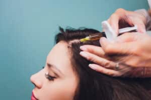Medical provider injects PRP in the scalp of a woman with thinning hair