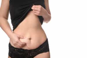 Woman wearing black undergarments pinches her postpartum belly before CoolSculpting® treatment
