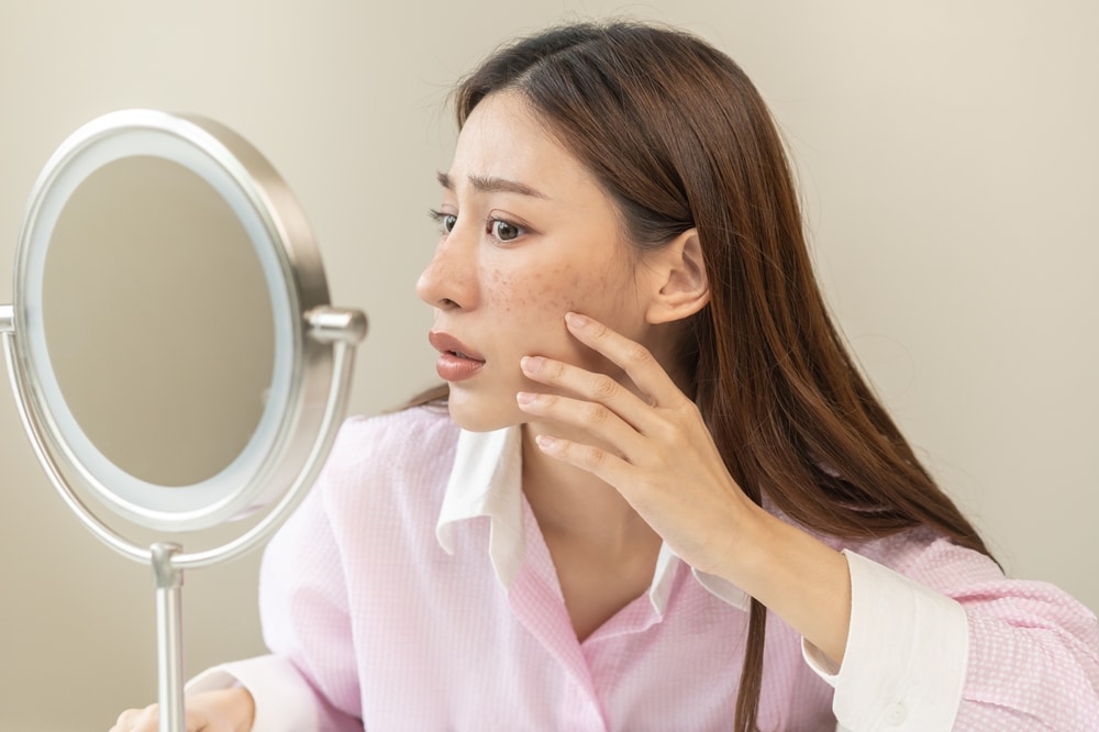 Woman, looking alarmed touches her cheek as she examines her age spots in the mirror